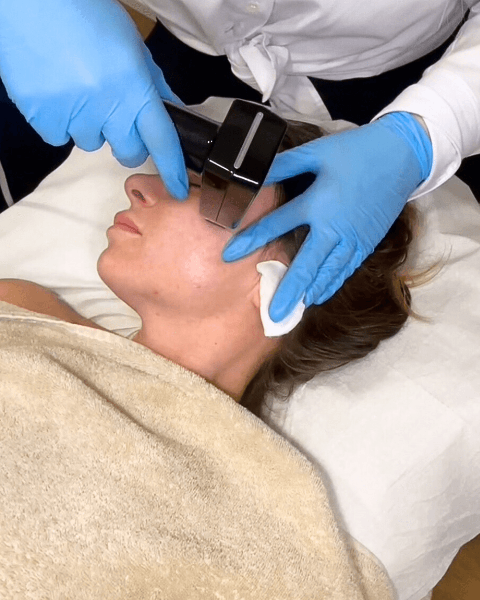 Beauty leta in Olten neu Morpheus 8 / RF-Neednling Behandlungen Beauty Leta beauty_leta Fillorta Pira Olten Microblading Permanent Make-Up Eyeliner Permanent Make-Up Lippen Kopfhautpigmentierung Wimpern Augenbrauen lasern Augenbrauenpflege Waxing Schröpfbehandlung Morpheus8 RF-Needling Tattooentfernung Diodenlaser {{brizy_dc_image_alt imageSrc=