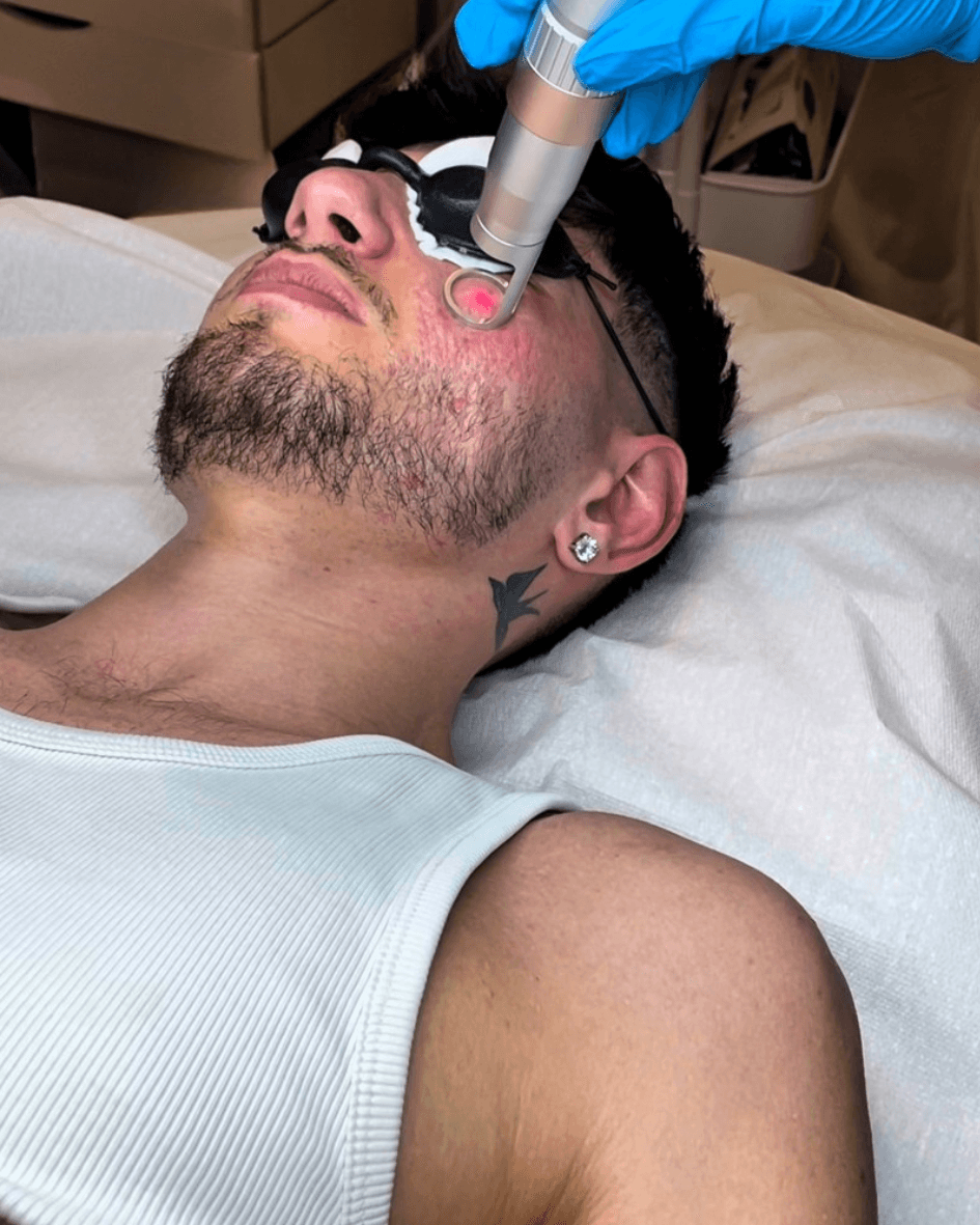 Beauty leta in Olten neu Morpheus 8 / RF-Neednling Behandlungen Beauty Leta beauty_leta Fillorta Pira Olten Microblading Permanent Make-Up Eyeliner Permanent Make-Up Lippen Kopfhautpigmentierung Wimpern Augenbrauen lasern Augenbrauenpflege Waxing Schröpfbehandlung Morpheus8 RF-Needling Tattooentfernung Diodenlaser {{brizy_dc_image_alt imageSrc=